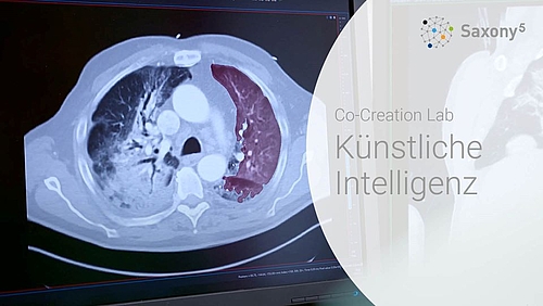 Lungensegmentierung mit einer KI CT-Bild einer Lunge